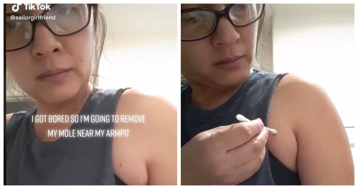 Liječnik upozorava na opasan TikTok trend koji može trajno oštetiti kožu