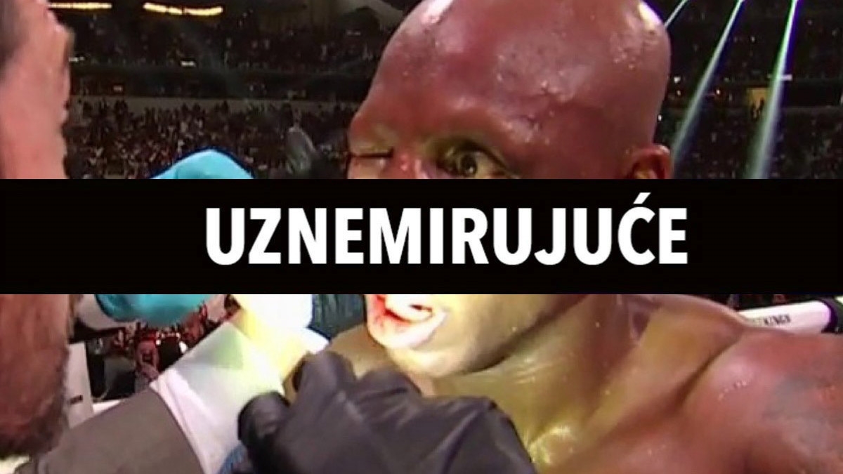 FOTO I VIDEO Ovako izgleda oko boksača nakon stravičnog udarca protivnika