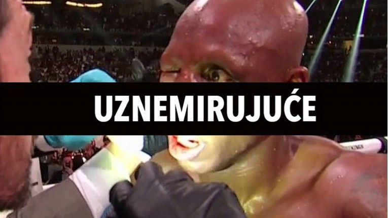 FOTO I VIDEO Ovako izgleda oko boksača nakon stravičnog udarca protivnika