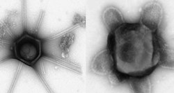FOTO U SAD-u nađena gomila rijetkih divovskih virusa, neki imali "ručice" i "frizure"