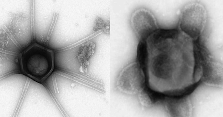 FOTO U SAD-u nađeni nevjerojatno veliki virusi s "ručicama" i "frizurama"
