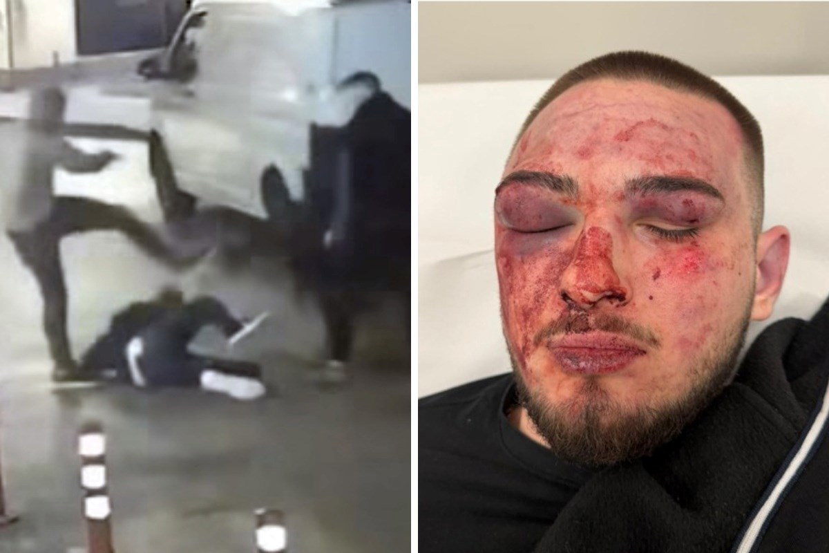 Uhićen i drugi napadač na maloljetnika u Rijeci. Ima 33 godine