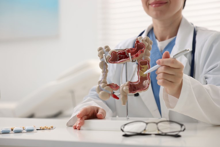 Pet vrsta raka naglo raste diljem svijeta - kako smanjiti rizik