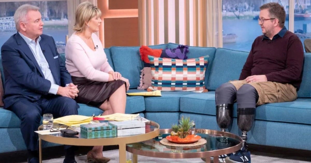 Britanski kirurg optužen da si je dao amputirati noge zbog novca od osiguranja