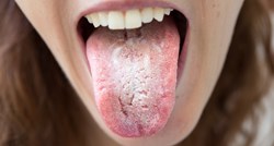 Evo što vaš jezik govori o vašem zdravlju, neki znakovi ukazuju na ozbiljne bolesti