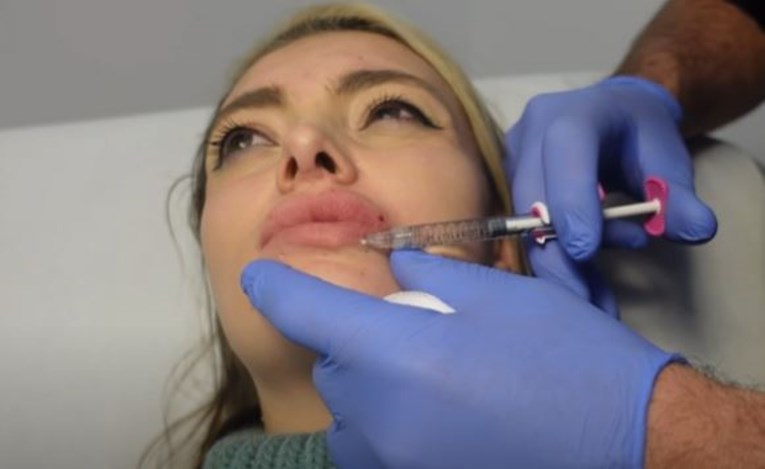 VIDEO Ella Dvornik povećala usne: Ne mogu se prestati gledati