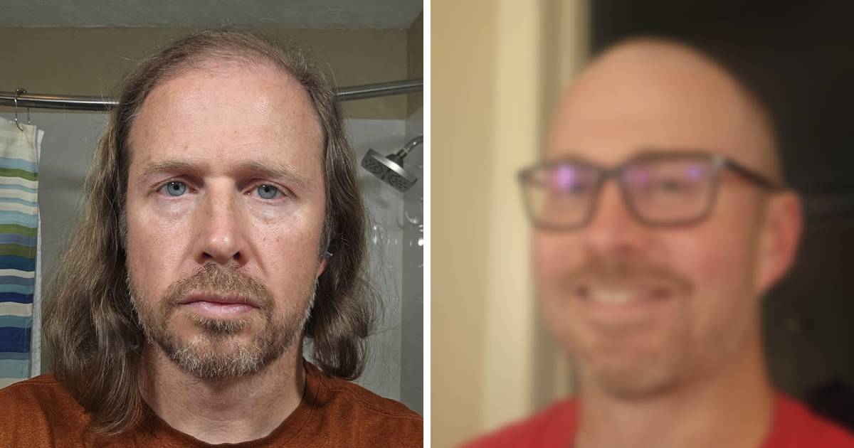 Počeo ćelavjeti pa obrijao glavu i oduševio: "Izgledaš 15 godina mlađe"