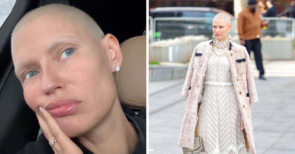 Bianca Balti nakon završetka kemoterapije: Kosa mi raste i život daje nove izazove