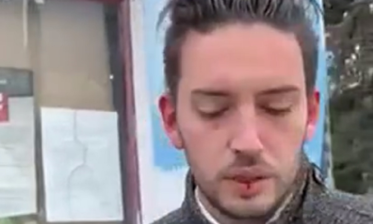 Pretučen jedan od vođa oporbe u Srbiji: "Napao ga je SNS, razbili su mu glavu"