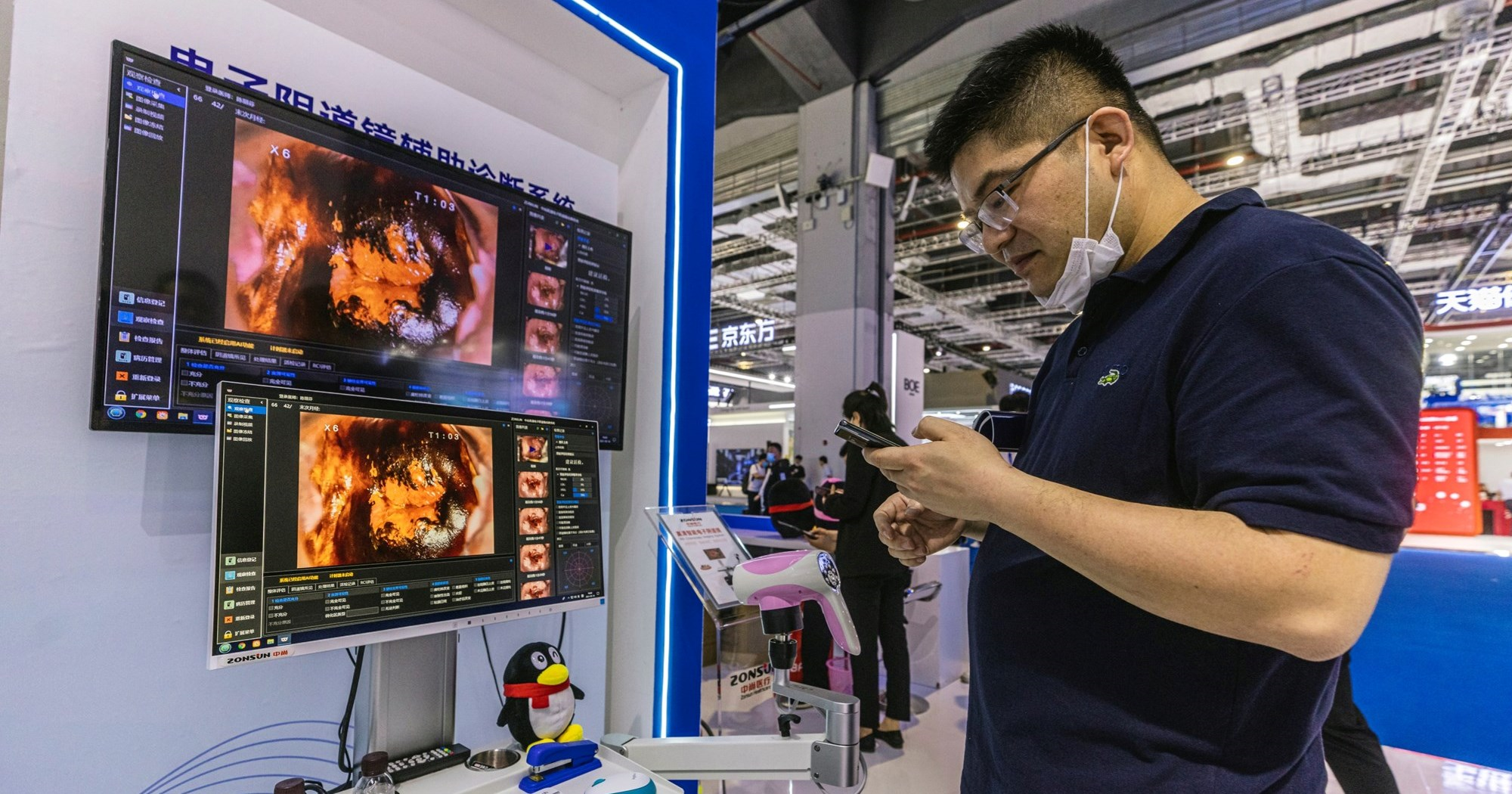 Istraživanje: Korištenje AI-ja pri kolonoskopiji smanjuje vještine liječnika