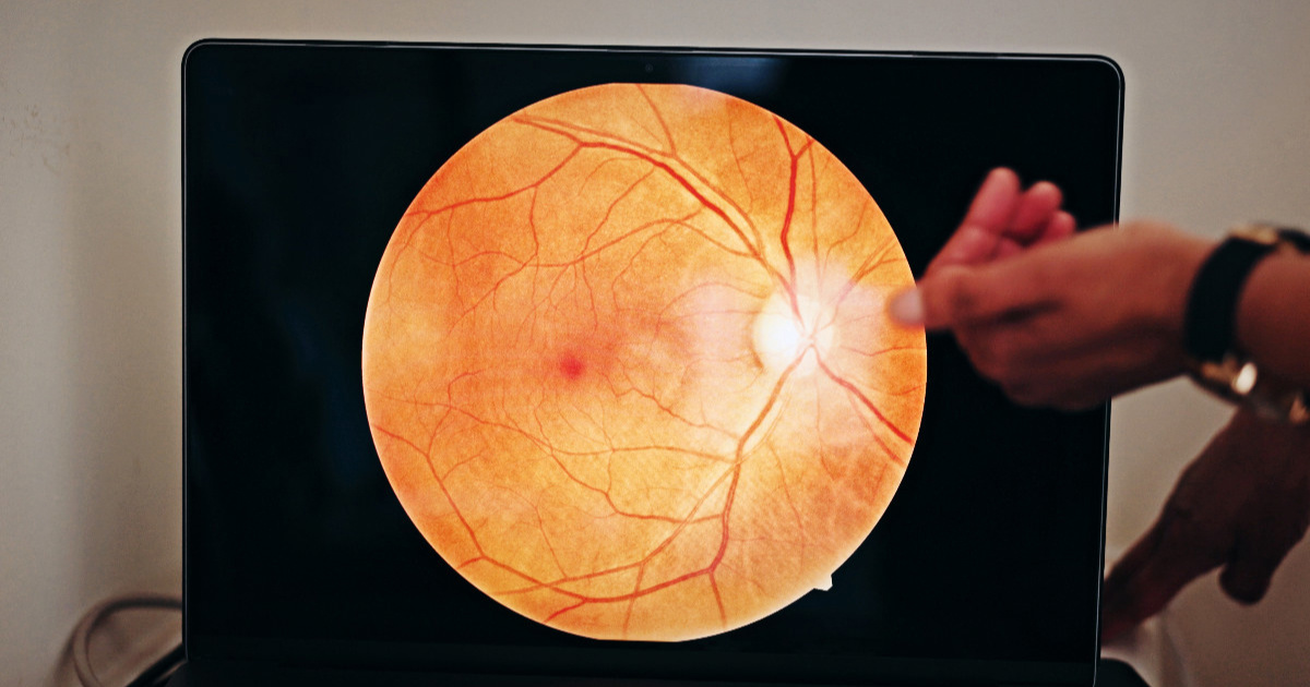 Kineski znanstvenici testirali oftalmološku kliniku koju vodi AI