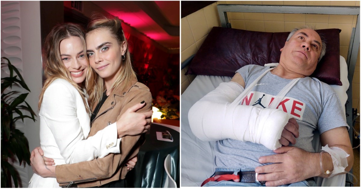 Paparazzo tvrdi: Prijatelji Care Delevingne i Margot Robbie su mi slomili ruku