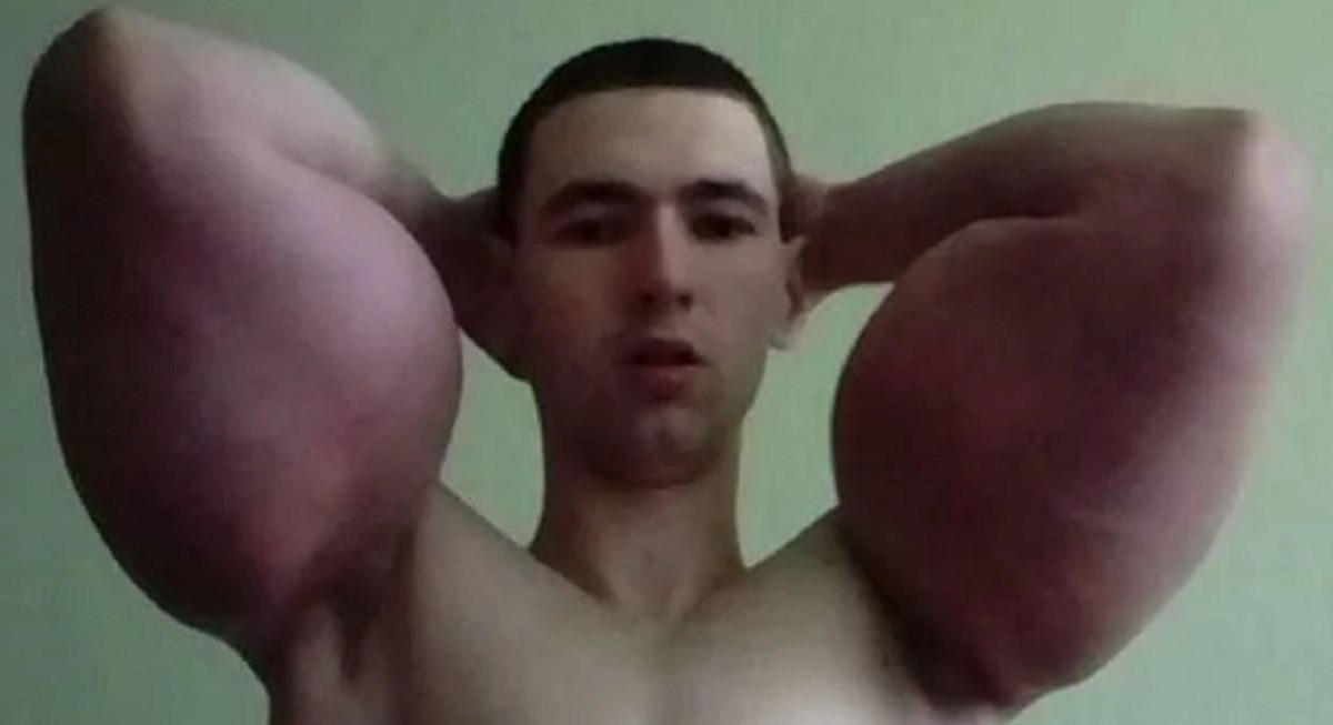 Ruski Popaj skoro ostao bez ruku. Sad snima kućne porniće