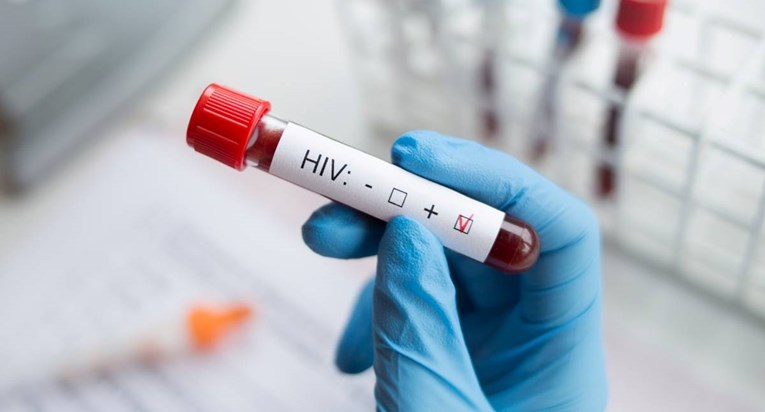 HIV je među nama već 40 godina. Sada je kronična bolest, a ne smrtna presuda