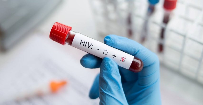HIV je otkriven prije 40 godina, sada više nije smrtna presuda