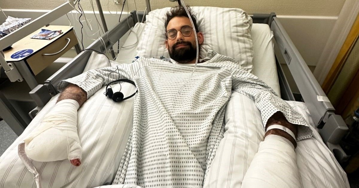 Nijemac na odmoru u Italiji dobio temperaturu, ubrzo ostao bez nogu i prstiju