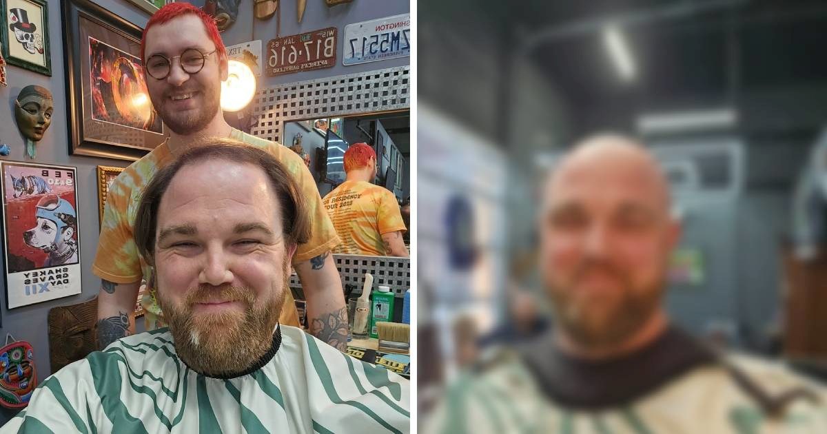 Obrijao glavu zbog gubitka kose, ljudi oduševljeni: "Izgledaš 30 godina mlađe"