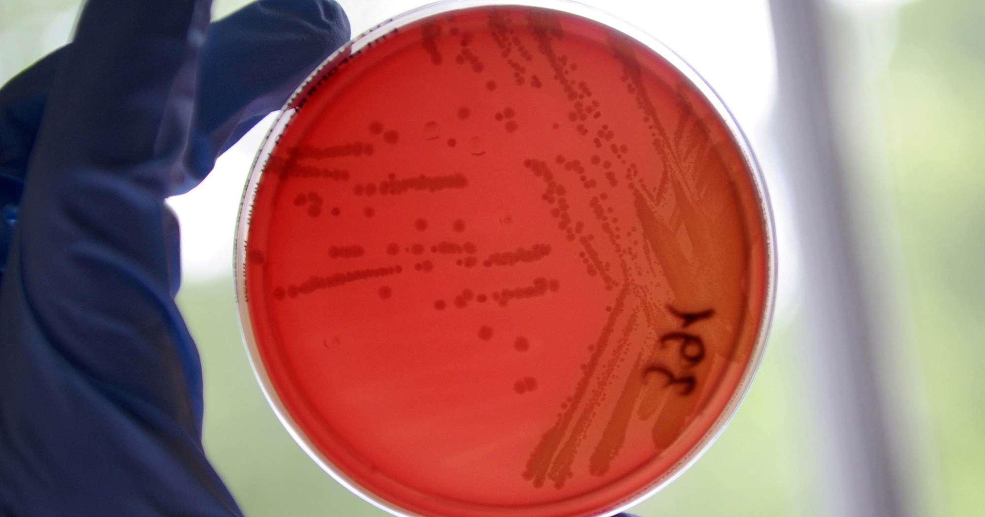 Znanstvenici u ledu otkrili soj bakterije star 5000 godina. Otporan je na antibiotike
