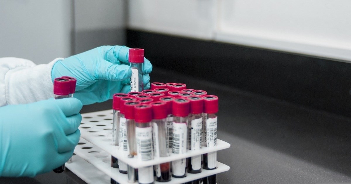 Virus koji ubija rak prvi put testiran na ljudima i pokazuje odlične rezultate
