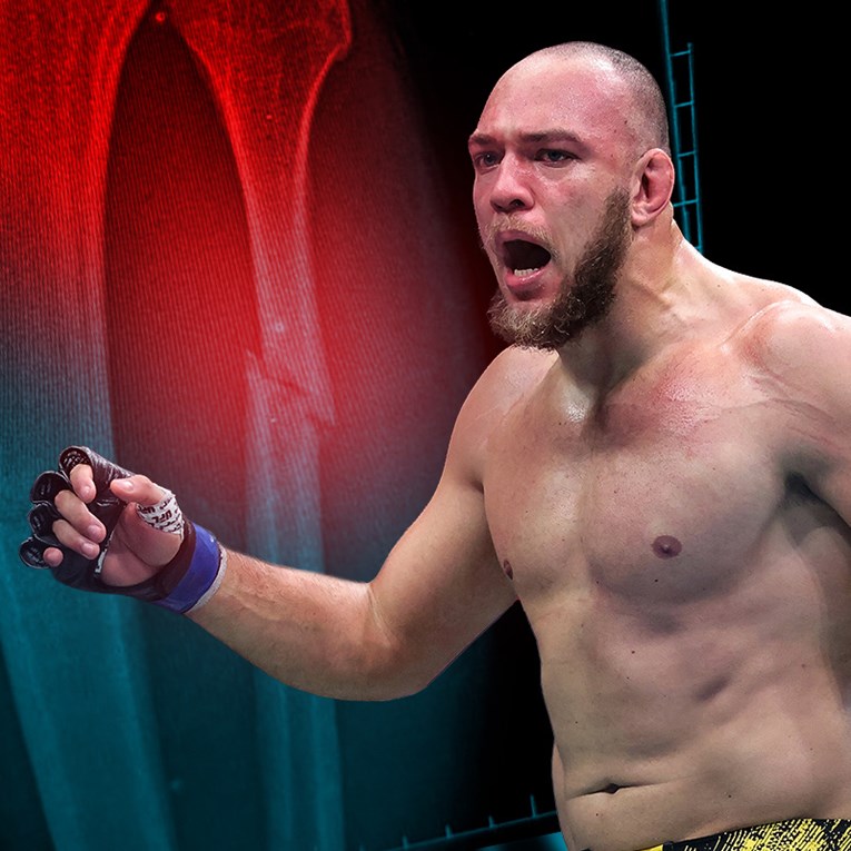 UFC borac pokazao nalaz. S ovakvom nogom je pobijedio suparnika