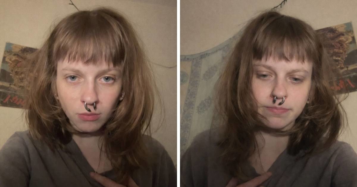 "Sindrom tužne bradavice": Viralni fenomen s TikToka koji muči gen Z-ovke