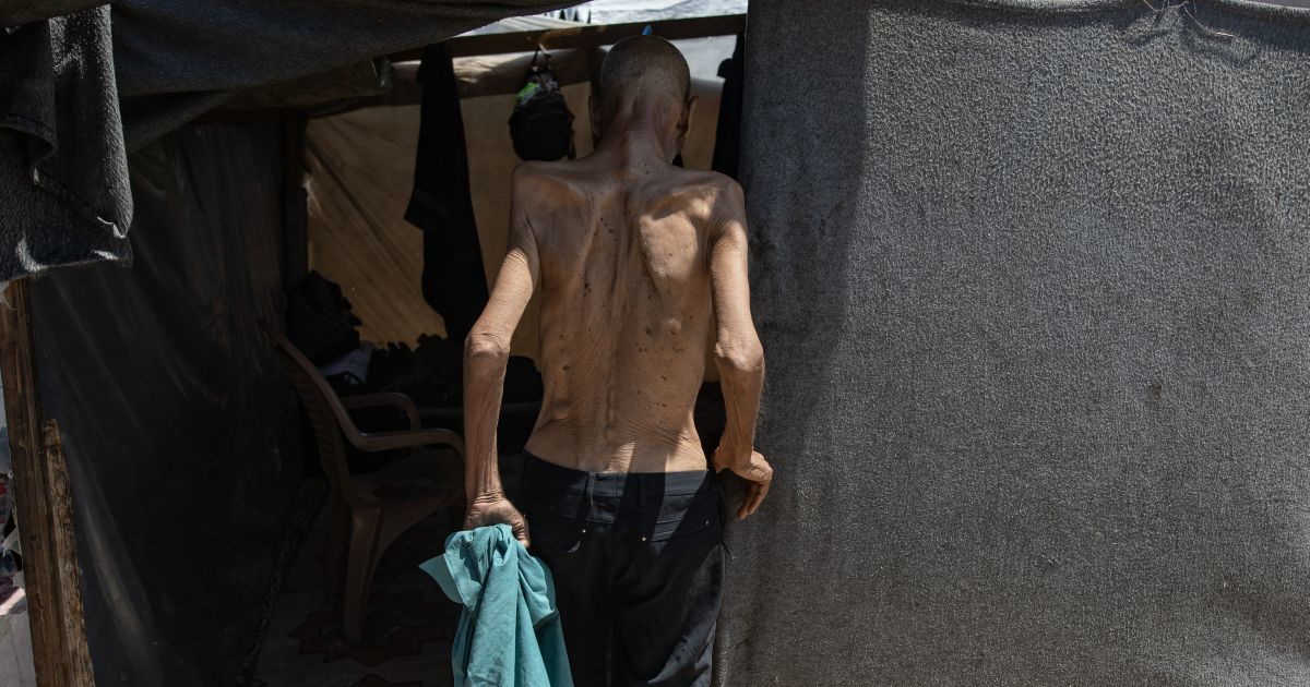 Lani je 266 milijuna ljudi patilo od gladi