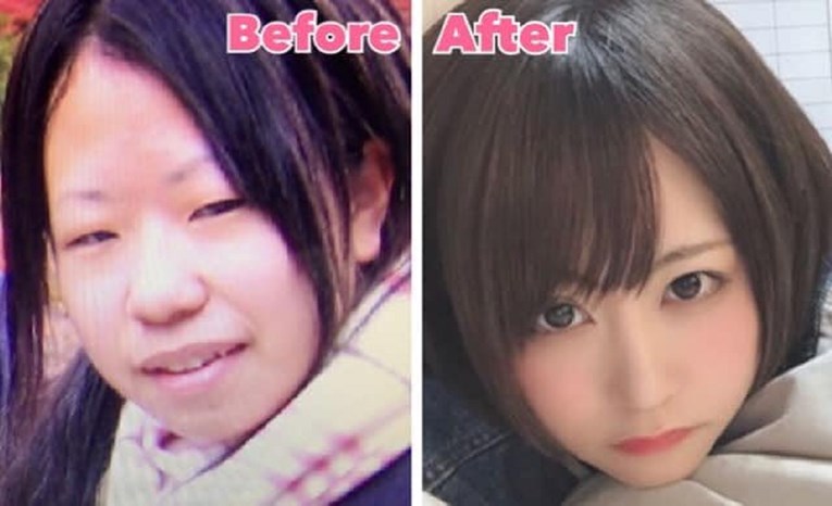Transformacija estetskom kirurgijom 25-godišnje djevojke zapanjila internet