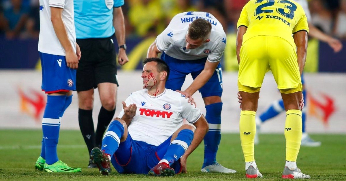 VIDEO Kalinić je završio na travi krvave glave. Nitko nije tražio penal