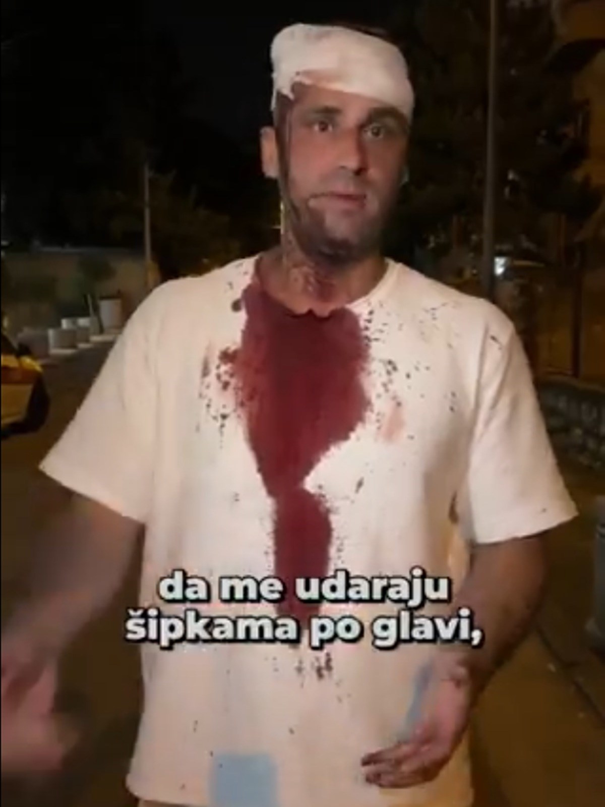 VIDEO U Beogradu pretučen zastupnik: "Šipkama su me udarali po glavi"