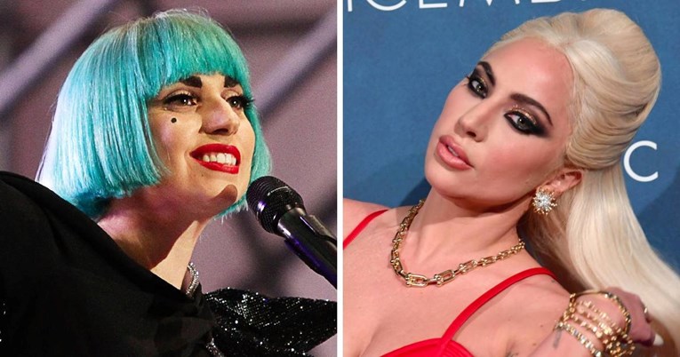 Plastični kirurg otkrio što je sve Lady Gaga radila na licu od početka karijere