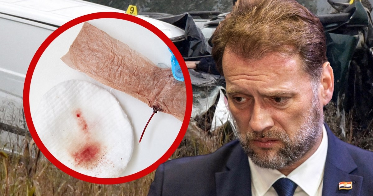 "Jesu mu vadili krv iz stražnjice?". Banožić: Alkohol sam dobio preko dezinficijensa