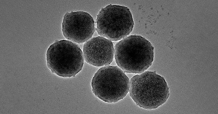 Znanstvenici stvorili sićušne magnetske nanorobote kojima će liječiti aneurizme mozga