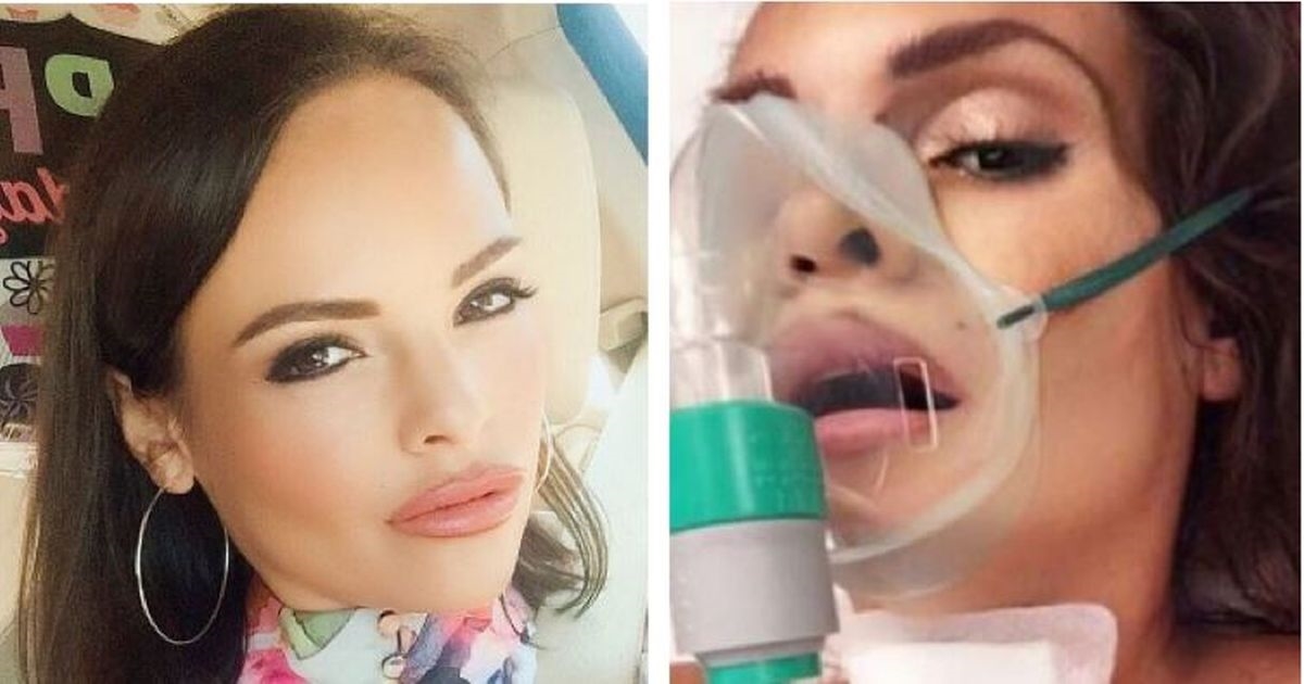Manekenka pričala da je korona izmišljena pa završila na respiratoru: Bila sam glupa