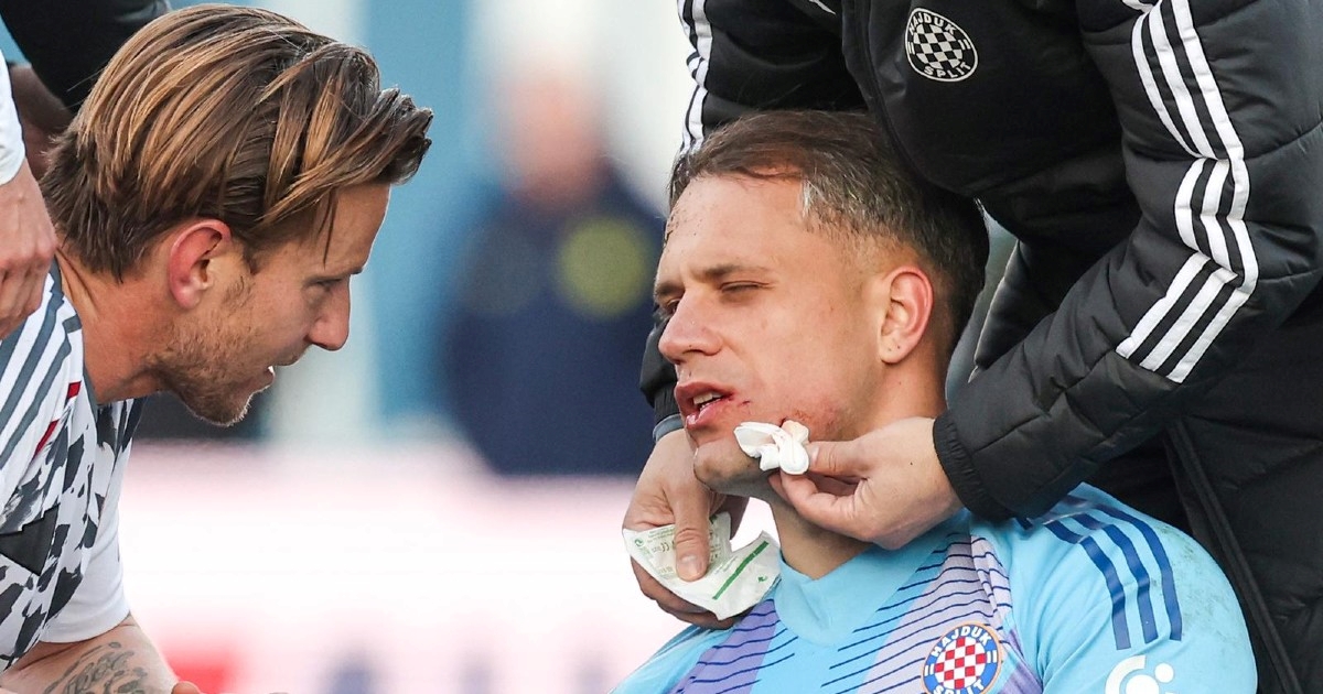 FOTO Galešić pogodio Lučića nogom u glavu pa dobio crveni