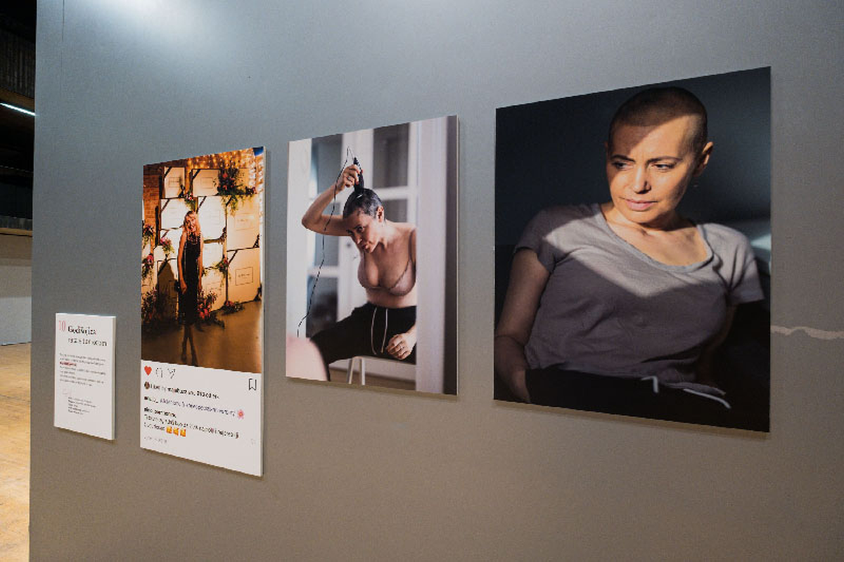 Hrvatska novinarka Instagram filterima i perikom skrivala rak dojke