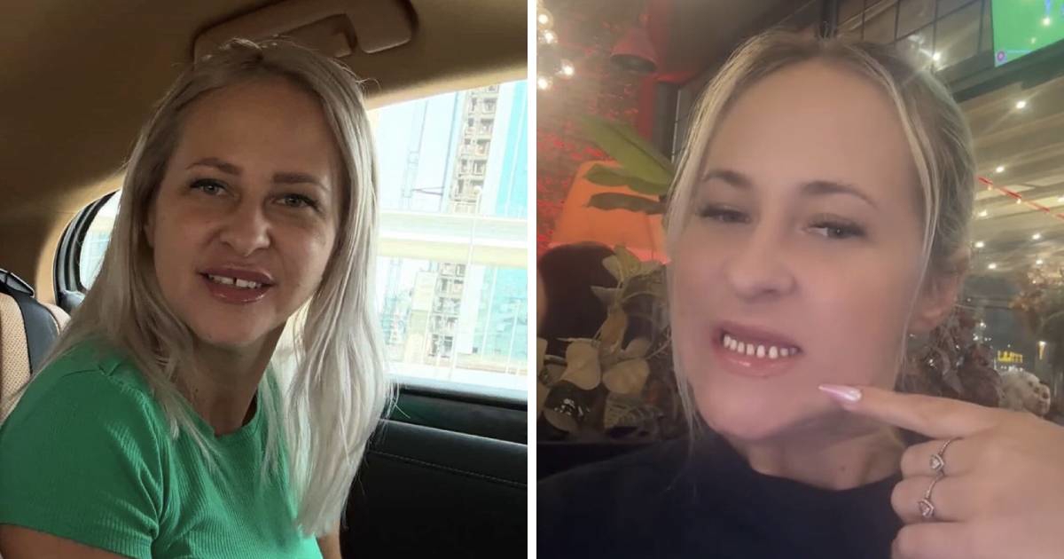 Otišla u Tursku po nove zube: "Sprdali su me da izgledam kao da imam 80 godina"