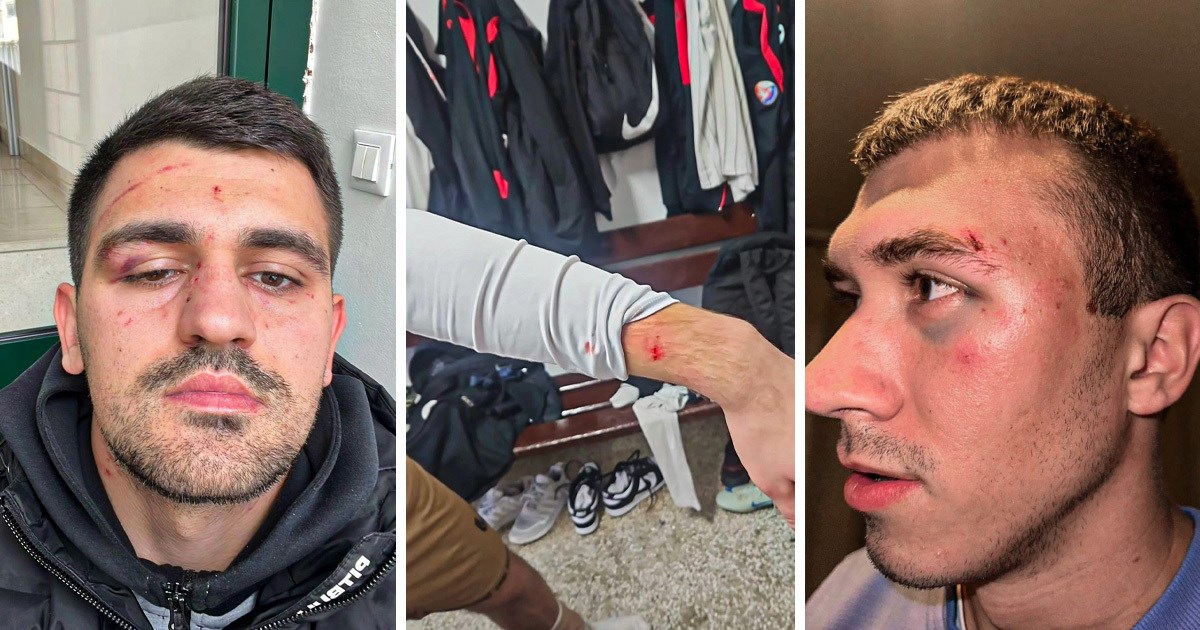 Igrači u hrvatskoj amaterskoj ligi dobili ukupno 23 mjeseca suspenzije zbog tučnjave