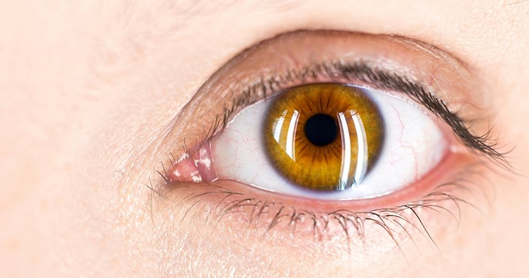 Specijalistica oftalmologije dijeli 3 znaka bolesti srca koji se mogu vidjeti u očima