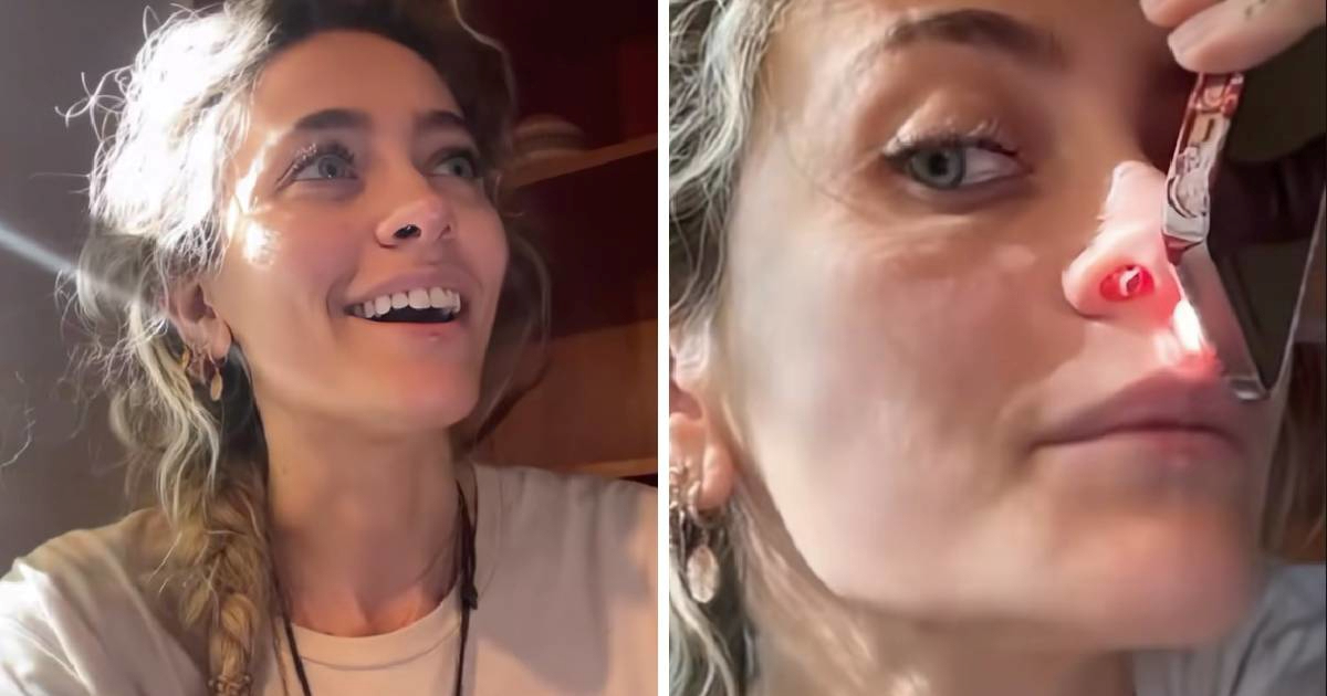 Paris Jackson pokazala rupu koja joj je nastala u nosu: "Nemojte se drogirati djeco"