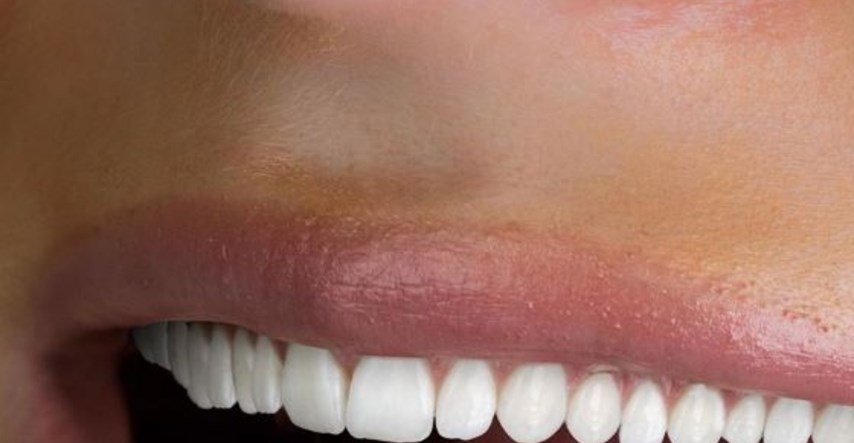 Reklamom za izbjeljivanje zuba zgrozili Instagram: "Ovako izgleda paraliza sna"