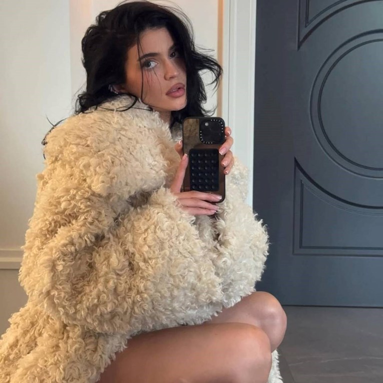 Što je to facijalna dismorfija i zašto sve više muči mlade žene