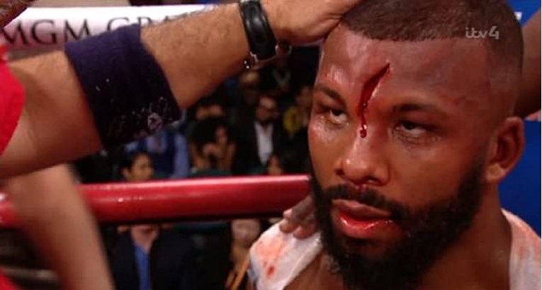 Uznemirujuće fotografije: Boksaču puklo čelo, krv curila po stolovima uz ring