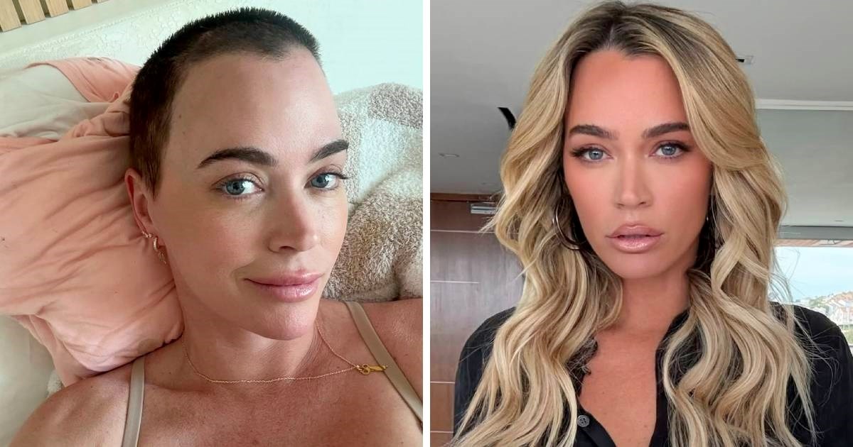 TV zvijezda nakon operacije tumora na mozgu: Imam ih još 5, dobit ću ovu bitku