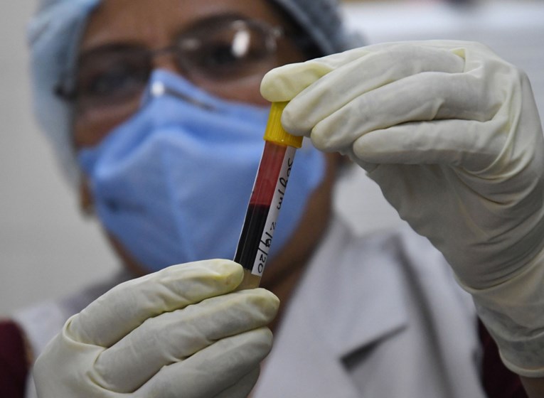 Znanstvenici: Imamo prvi krvni test za dijagnozu sindroma kroničnog umora