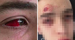 HDZ-ovac i MMA borac brutalno pretukao dečka (17) u Dubrovniku