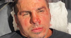 Uznemirujući video: Poznati kečer ostao ležati u lokvi krvi nakon pogreške protivnika
