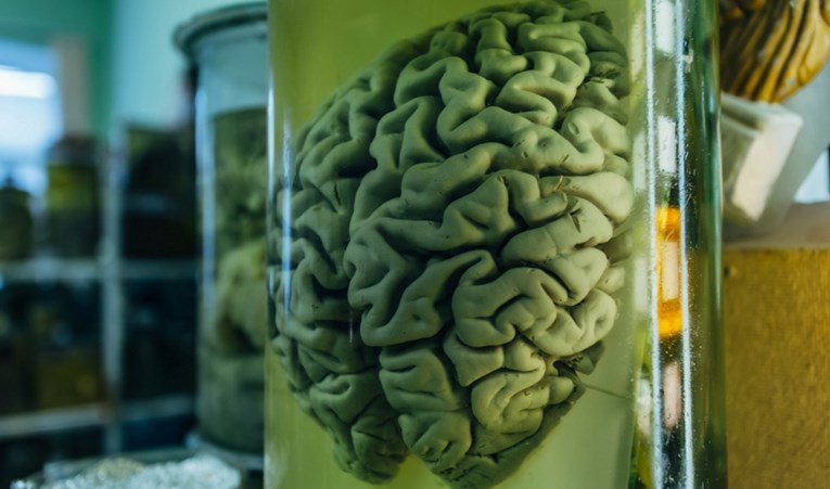 Istraživanje: Mozak modernog čovjeka razvio se kasnije nego što se misli