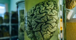 Istraživanje: Mozak modernog čovjeka razvio se kasnije nego što se misli