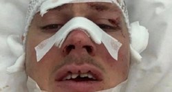 Srpski nogometaš nakon nesreće kod Lipovljana ne može pričati. Usta su mu u koncima