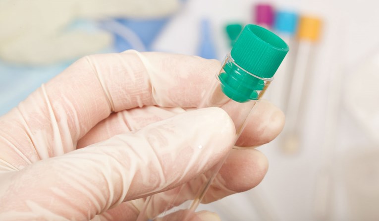 Cjepivo za koronavirus francuski Institut Pasteur planira razviti za 20 mjeseci